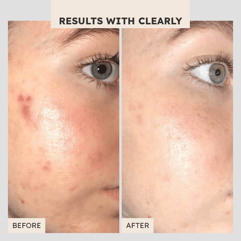 So Fresh pH Balancing Cleanser - Clearly Basics